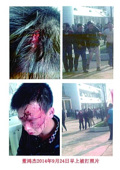 學生出校門買早點被門衛打破頭 警方已介入調查-中國教育2