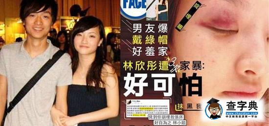 林欣彤慘遭三次家暴 男友稱被戴綠帽1
